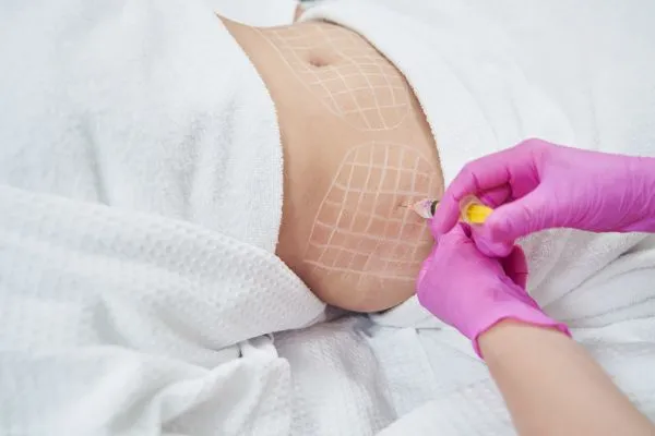 image of fat dissolving injections on love handles to help combat weight gain Newton Mearns